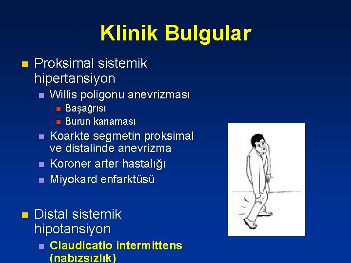 Klinik Bulgular n Proksimal sistemik hipertansiyon n Willis poligonu anevrizması n n n Başağrısı