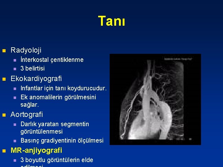 Tanı n Radyoloji n n n Ekokardiyografi n n n Infantlar için tanı koydurucudur.