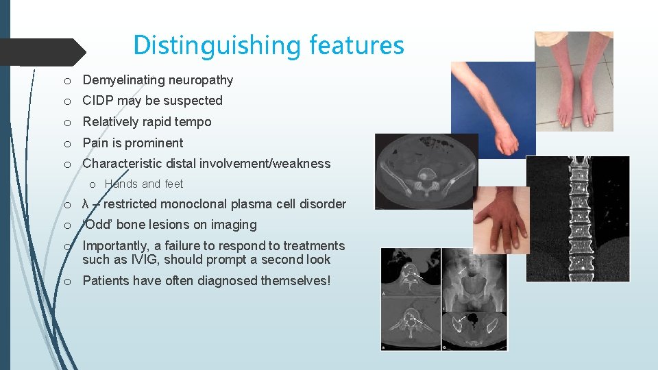 Distinguishing features o Demyelinating neuropathy o CIDP may be suspected o Relatively rapid tempo