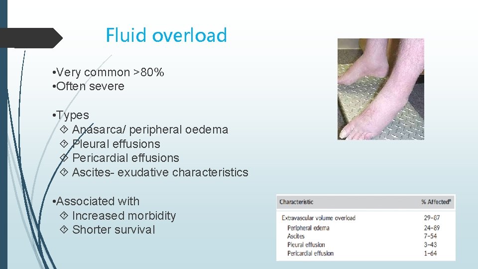 Fluid overload • Very common >80% • Often severe • Types Anasarca/ peripheral oedema