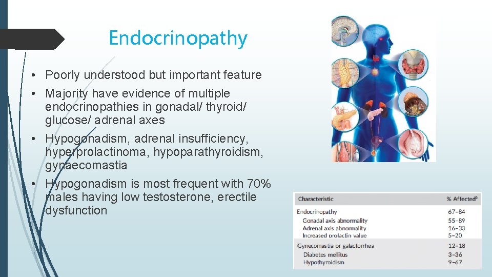 Endocrinopathy • Poorly understood but important feature • Majority have evidence of multiple endocrinopathies