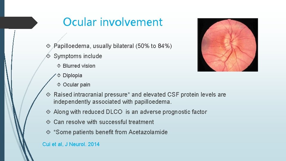 Ocular involvement Papilloedema, usually bilateral (50% to 84%) Symptoms include Blurred vision Diplopia Ocular