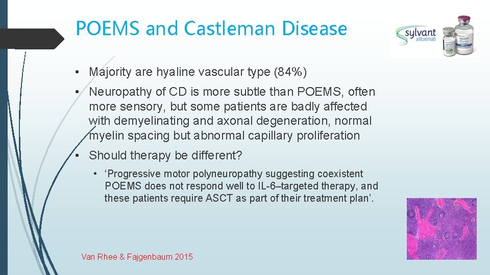POEMS and Castleman Disease • Majority are hyaline vascular type (84%) • Neuropathy of
