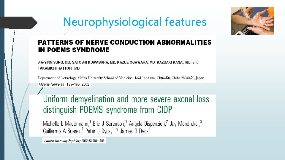 Neurophysiological features 