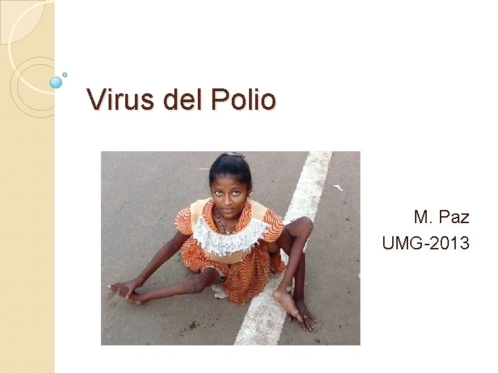 Virus del Polio M. Paz UMG-2013 