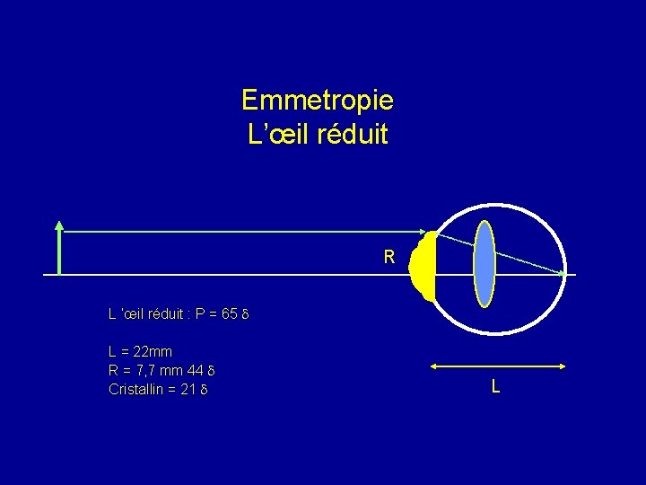 Emmetropie L’œil réduit R L ’œil réduit : P = 65 d L =