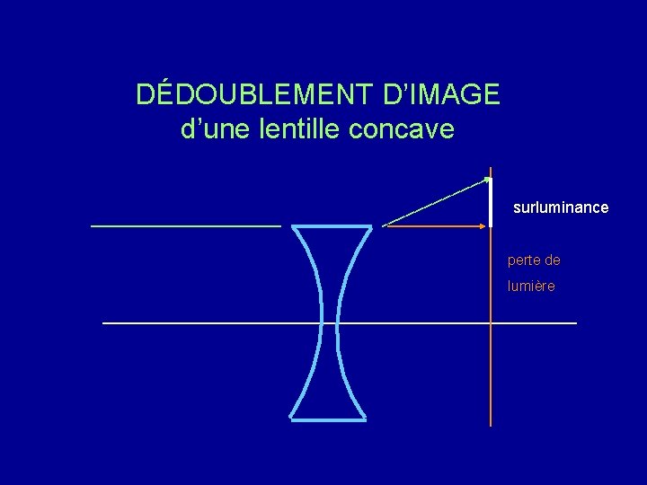 DÉDOUBLEMENT D’IMAGE d’une lentille concave surluminance perte de lumière 