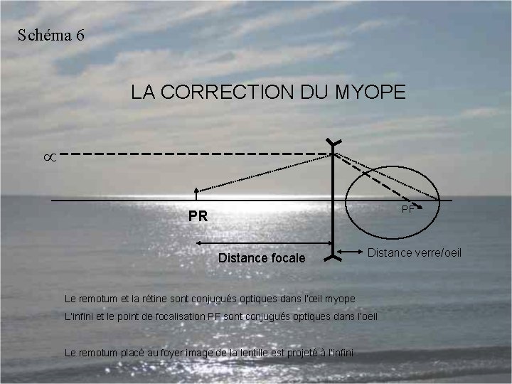 Schéma 6 LA CORRECTION DU MYOPE PF PR Distance focale Distance verre/oeil Le remotum