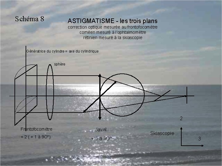Schéma 8 ASTIGMATISME - les trois plans correction optique mesurée au frontofocomètre cornéen mesuré