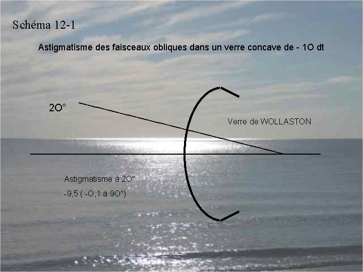 Schéma 12 -1 Astigmatisme des faisceaux obliques dans un verre concave de - 1