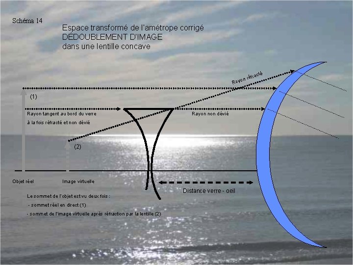 Schéma 14 Espace transformé de l’amétrope corrigé DÉDOUBLEMENT D’IMAGE dans une lentille concave R