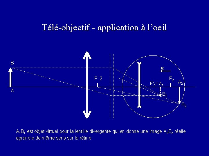 Télé-objectif - application à l’oeil B e F ’ 2 F’ 1= A 1