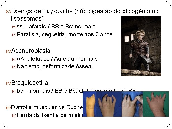  Doença de Tay-Sachs (não digestão do glicogênio no lisossomos) ss – afetato /