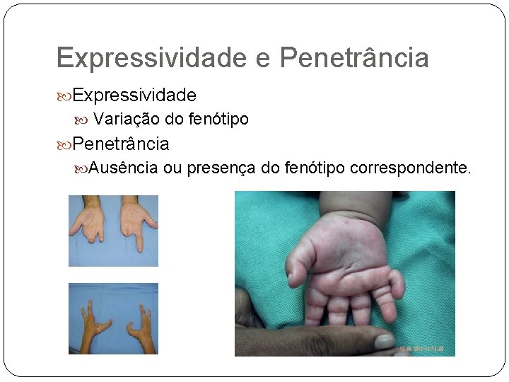 Expressividade e Penetrância Expressividade Variação do fenótipo Penetrância Ausência ou presença do fenótipo correspondente.