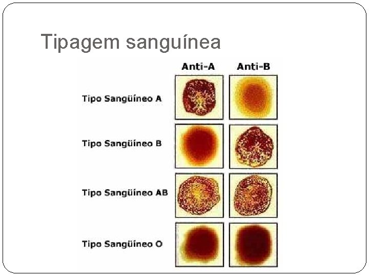 Tipagem sanguínea 