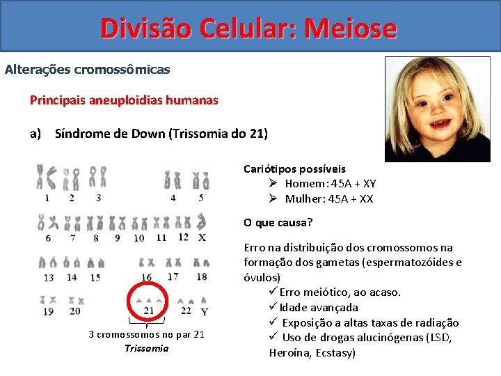 Divisão Celular: Meiose Alterações cromossômicas Principais aneuploidias humanas a) Síndrome de Down (Trissomia do