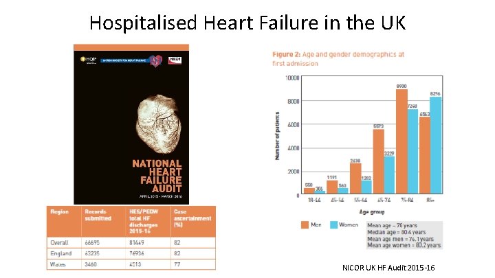 Hospitalised Heart Failure in the UK NICOR UK HF Audit 2015 -16 Hospitalised Heart Failure in the UK NICOR UK HF Audit 2015 -16