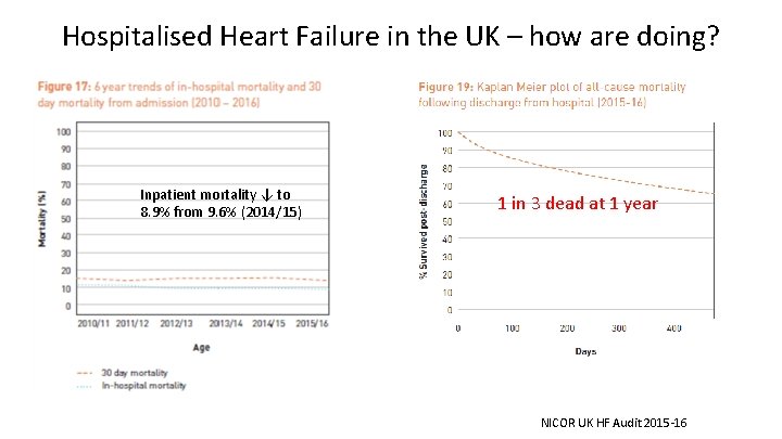 Hospitalised Heart Failure in the UK – how are doing? Inpatient mortality ↓ to Hospitalised Heart Failure in the UK – how are doing? Inpatient mortality ↓ to