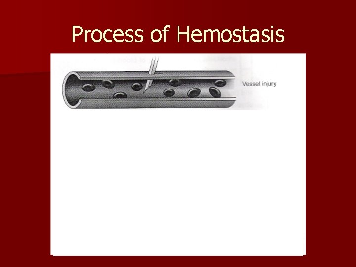 Process of Hemostasis 