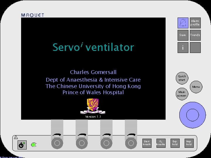 Alarm profile 12 -25 15: 32 Save Servoi ventilator Trends i Charles Gomersall Dept