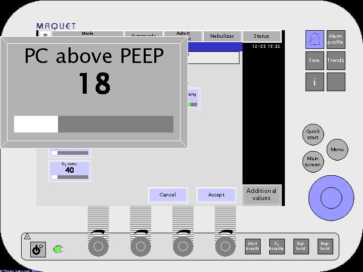 Mode Volume Control Automode Basic 18 18 PC above PEEP Resp. Rate 15 Nebulizer