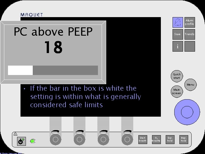 PC above PEEP Alarm profile 12 -25 15: 32 Save 18 Trends i Quick