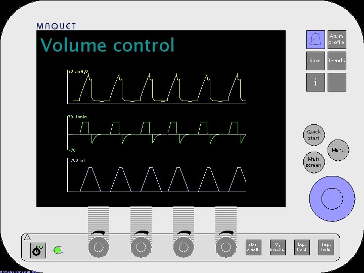 Volume control Alarm profile 12 -25 15: 32 Save Trends 50 cm. H 2