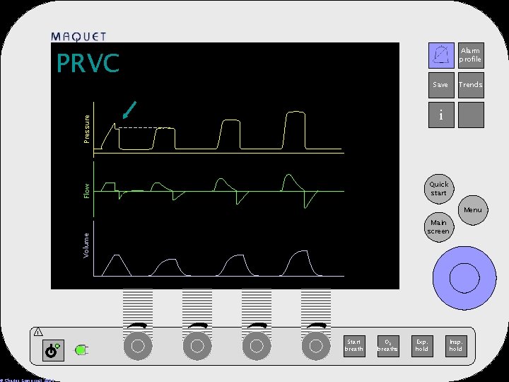 12 -25 15: 32 Save Trends i Pressure PRVC Alarm profile Flow Quick start