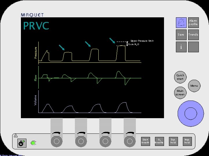 PRVC Alarm profile 12 -25 15: 32 Save Upper Pressure limit 5 cm H