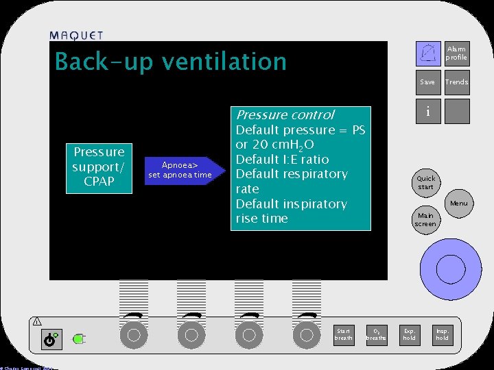 Back-up ventilation Alarm profile 12 -25 15: 32 Save i Pressure control Pressure support/