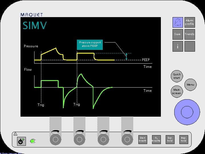 SIMV Pressure Alarm profile 12 -25 15: 32 Save Pressure support above PEEP Trends