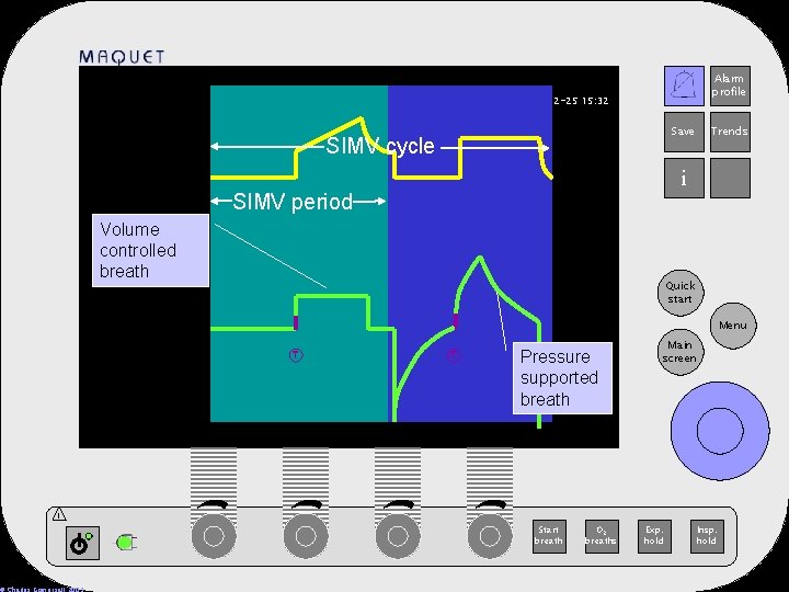 Alarm profile 12 -25 15: 32 Save SIMV cycle Trends i SIMV period Volume