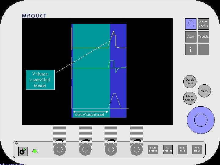 Alarm profile 12 -25 15: 32 Save Trends i Volume controlled breath Quick start