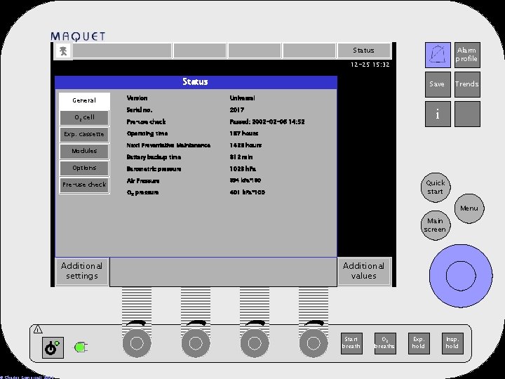 Status Alarm profile 12 -25 15: 32 Status General O 2 cell Exp. cassette