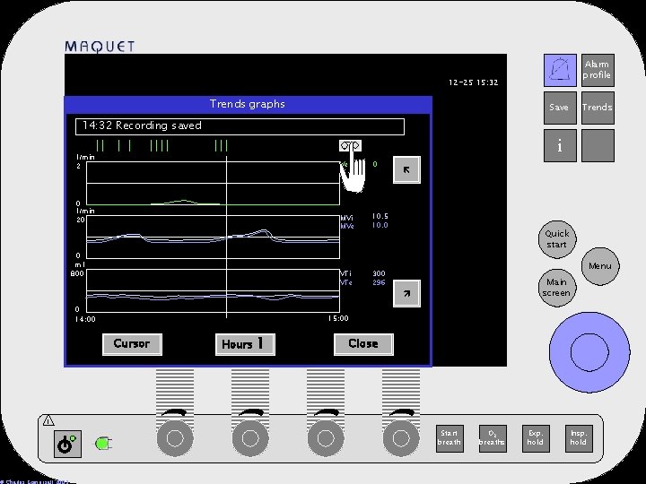 Alarm profile 12 -25 15: 32 Trends graphs Save Trends 14: 32 Recording saved