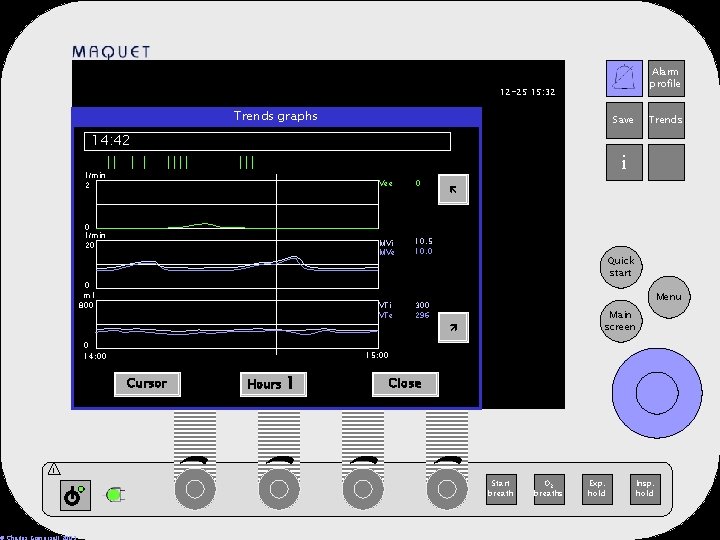 Alarm profile 12 -25 15: 32 Trends graphs Save Trends 14: 42 i l/min