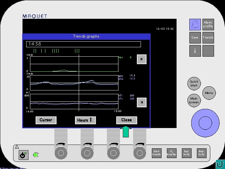 Alarm profile 12 -25 15: 32 Trends graphs Save Trends 14: 38 i l/min