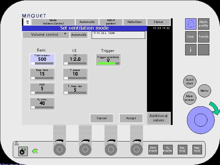 Mode Volume Control Volume control Basic Automode Admit patient Set ventilation mode Automode Trigger