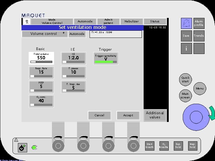 Mode Volume Control Volume control Basic Automode Admit patient Set ventilation mode Automode Trigger