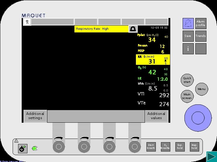 12 -25 15: 32 Respiratory Rate: High Pplat (cm. H 2 O) Pmean 34