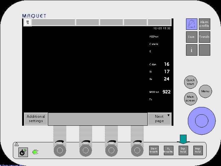Alarm profile 12 -25 15: 32 Save PEEPtot Trends C static i E C