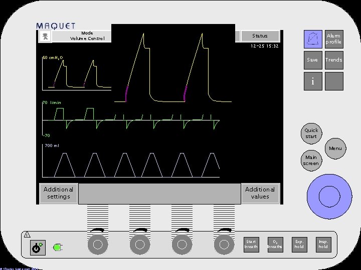 Mode Volume Control Automode T Admit patient Nebulizer Status Alarm profile 12 -25 15: