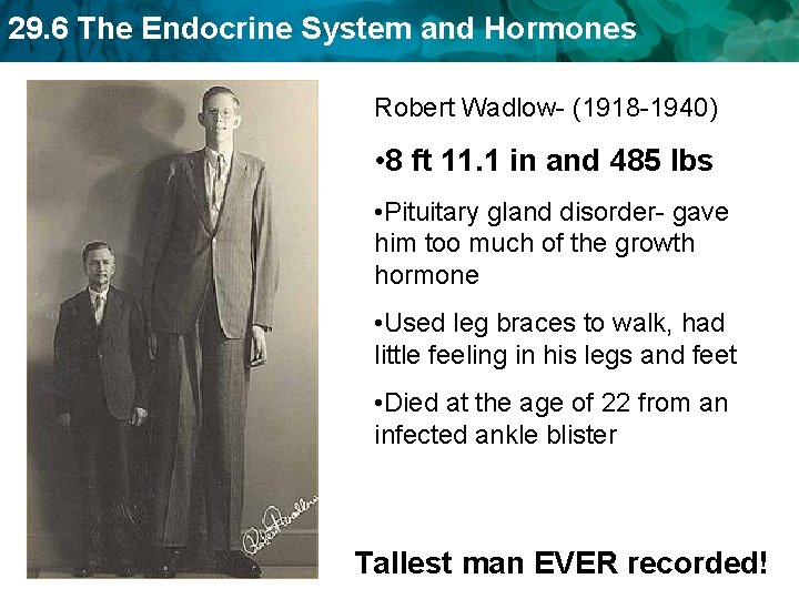 29. 6 The Endocrine System and Hormones Robert Wadlow- (1918 -1940) • 8 ft 29. 6 The Endocrine System and Hormones Robert Wadlow- (1918 -1940) • 8 ft