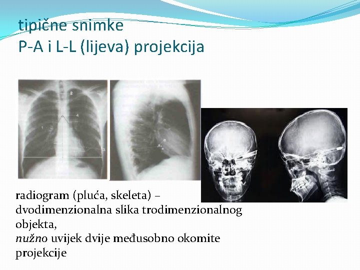 tipične snimke P-A i L-L (lijeva) projekcija radiogram (pluća, skeleta) – dvodimenzionalna slika trodimenzionalnog