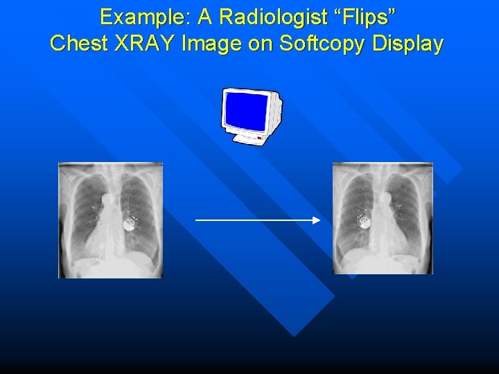 Example: A Radiologist “Flips” Chest XRAY Image on Softcopy Display 