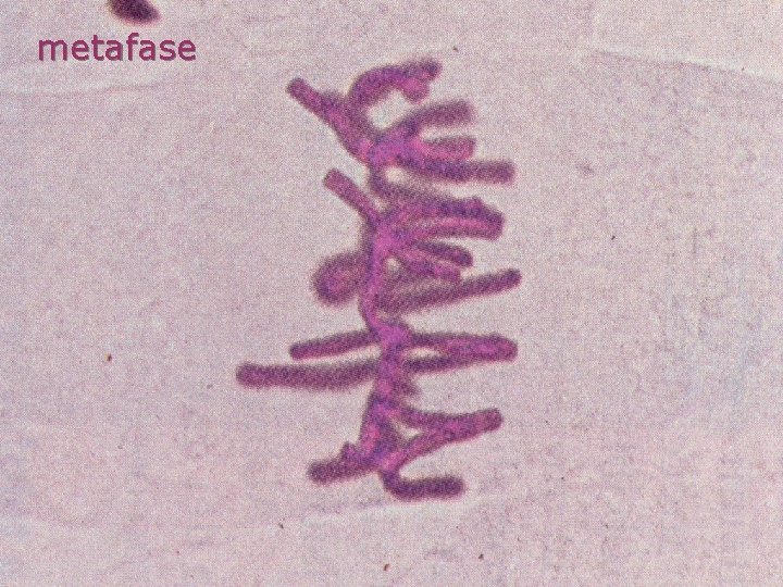 metafase 