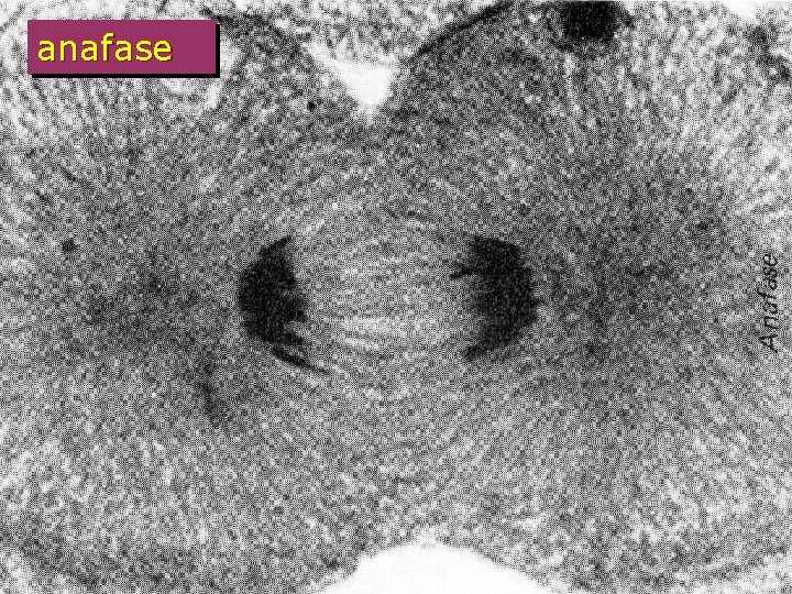 anafase 