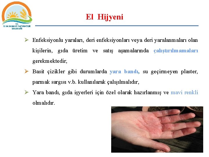 El Hijyeni Ø Enfeksiyonlu yaraları, deri enfeksiyonları veya deri yaralanmaları olan kişilerin, gıda üretim