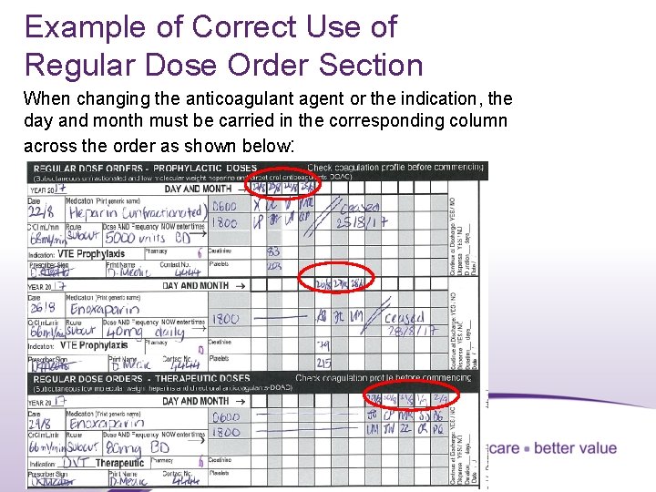 Example of Correct Use of Regular Dose Order Section When changing the anticoagulant agent