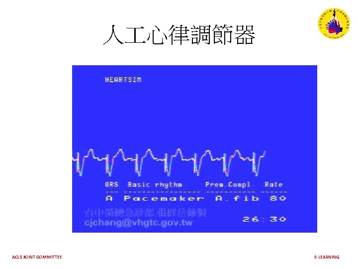 人 心律調節器 ACLS JOINT COMMITTEE E-LEARNING 